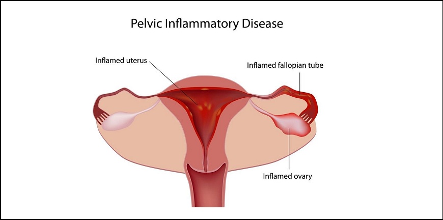 Best Infertility Treatment Specialist in Pune