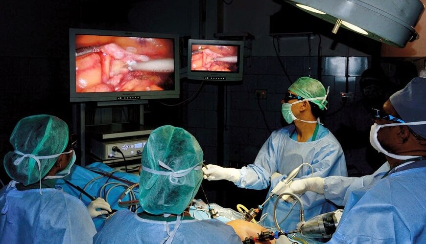 Laparoscopy