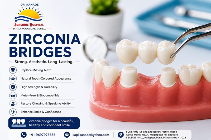 Zirconia Bridges in Pune