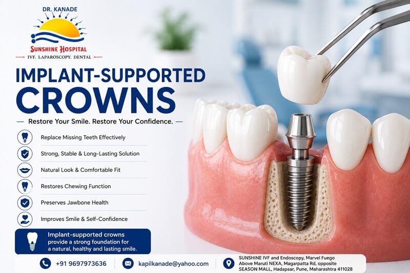 Implant-Supported Crowns in Pune